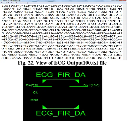 Fig. 22. View of ECG Output100.txt file 