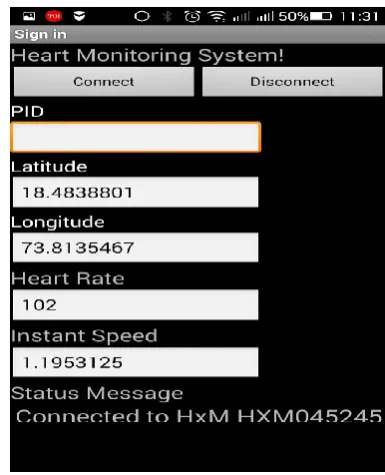 figure shows the actual view of our heart rate monitoring smart 