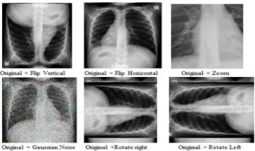Figure 3: Sample Superimposed Images 