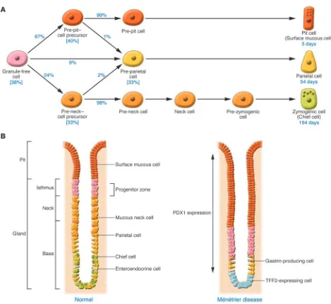 Figure 4Ontogeny of cell lineages in the normal gastric body and proposed model for the pathogenesis of Ménétrier disease