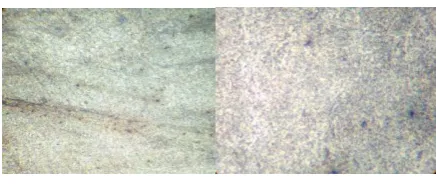 Fig 1- Micro structure of as received EN 24, a) at 100X, 