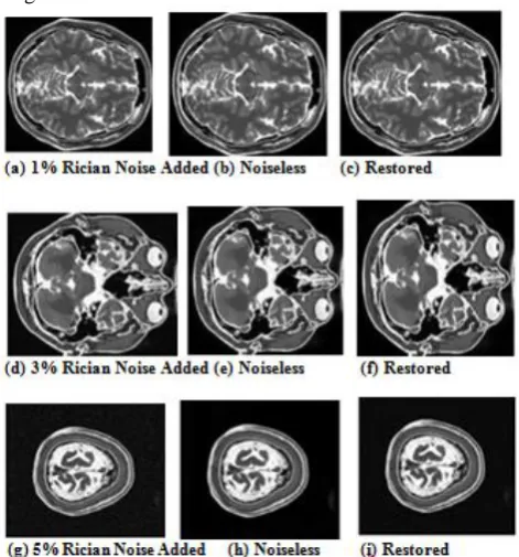 Figure 3. MRI Brain Image  