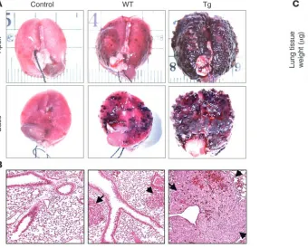 Figure 4Tie-Tg mice exhibit enhanced B16-BL6 metastatic lung disease. (