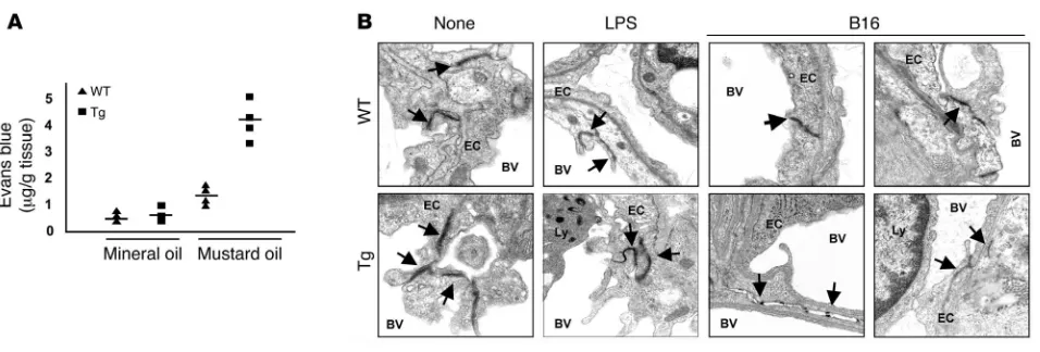 Figure 6Enhanced EC leakiness in the transgenic mice. (A) Vascular permeability in transgenic (line 4; n = 4) and the WT mice (n = 4) was measured in response to mustard oil with Evans blue dye