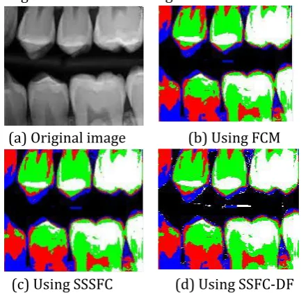 Fig. 2. The illustration of segmentation results on Image 1 