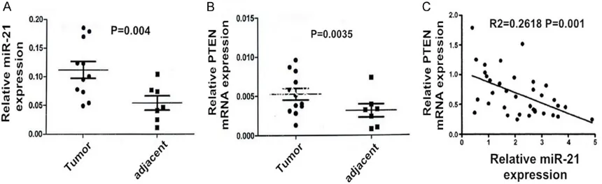 Figure 1. Real-time PCR for the relative expression level of miR-21 (A) and PTEN mRNA (B) in endometrial carcinoma tissues and the adjacent non-tumor tissues