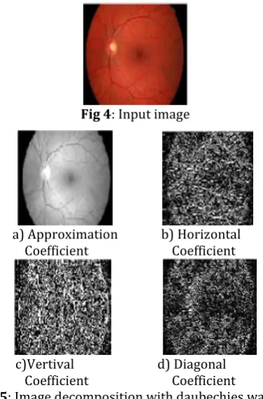 Fig 5: Image decomposition with daubechies wavelet 