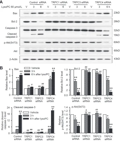 Figure 8: trPc channels are involved in apoptotic signaling induced by lysoPc. A.and p-Akt in human coronary artery SMCs transfected with 50 nM control siRNA, TRPC1 siRNA, TRPC3 siRNA or TRPC4 siRNA for 72 h, and then treated with vehicle (V) or 60 μmol/L 