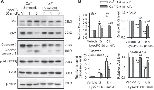 Figure 7: Intracellular signaling involved in apoptosis induced by lysoPc. A. Western blots of Bax, Bcl-2, caspase-3, and p-Akt(S473) in human coronary artery SMCs treated with 60 μmol/L lysoPC for 3 h or 6 h incubation with medium containing 1.8 or 0.9 mm