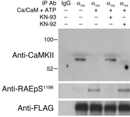 Figure 5CaMKIIγC forms a signaling complex with α1H channels that is dis-rupted by S1198 phosphorylation