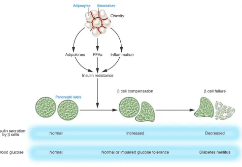 Figure 1Development of type 2 diabetes. Insulin resistance associated with obesity is induced by adipokines, FFAs, and chronic inflammation in adipose tissue