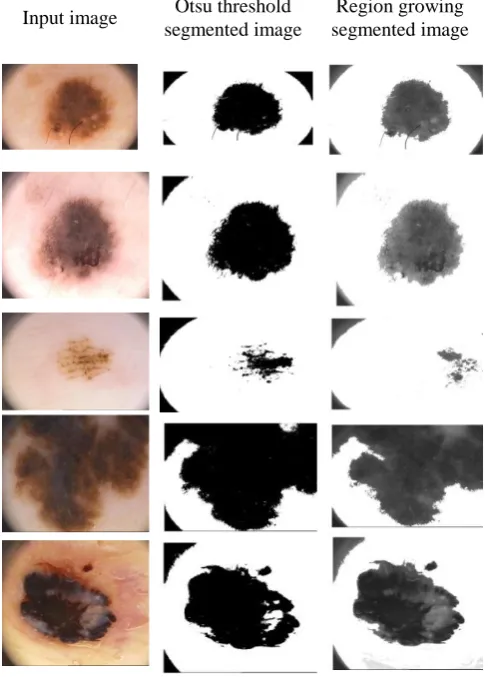 Fig. 2 shows the segmented sample images from both the methods.   
