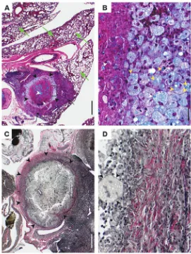 Figure 4Histopathology of 2 different lungs obtained from CBA/J mice 