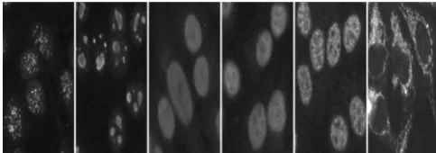 Figure 1: (a)Centromere (b) Nuclear Membrane (c) Golgi (d) Homogeneous (e)Speckled (f)Nucleolar