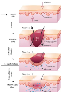 Figure 2Role of barrier acquisition in the epidermal response to wound 
