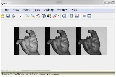 Fig.7 Binary Image 