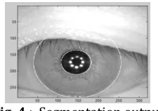 Fig. 4  :  Segmentation output 
