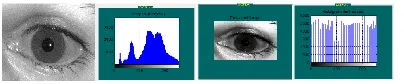Fig.5: Original Eye Histogram & Pre-Processing Histogram 