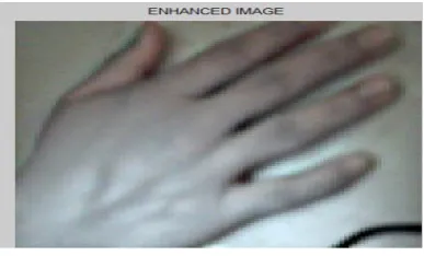Fig 5.1 Enhanced Image after pre-processing  