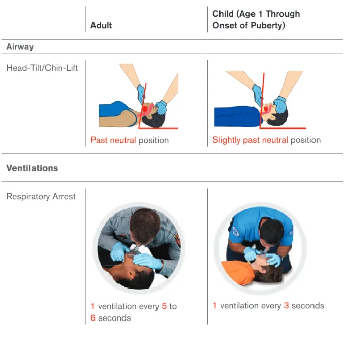 Table 1-2 Airway and Ventilation Differences: Adult and Child