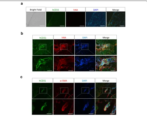 Fig. 7 Endothelial induced MESP1 progenitor cells differentiated into blood vessels in critical limb ischemia mouse.Scale bars: 100control- treated ischemic hindlimb, no human CD31 (hCD31) and human nuclei (hNA) can be seen on day 28
