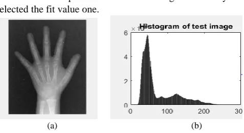 Fig. 5: (a) Upload X-ray Images (b) Histogram Image 