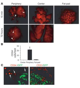 Figure α (Figure 3, B and C) Human CD34blocked by antibodies to integrin B and C). The adhesion of CD34 cells to endothelia was – mononuclear cells also home to peripheral tumor vasculature