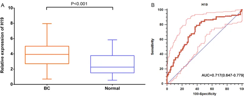 Figure 1. Diagnostic performance of lncRNA H19 in human bladder cancer (BC) tissue. A: Relative expression levels of lncRNA H19 in BC tissue and normal tissues