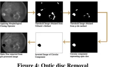 Figure 4: Optic disc Removal 