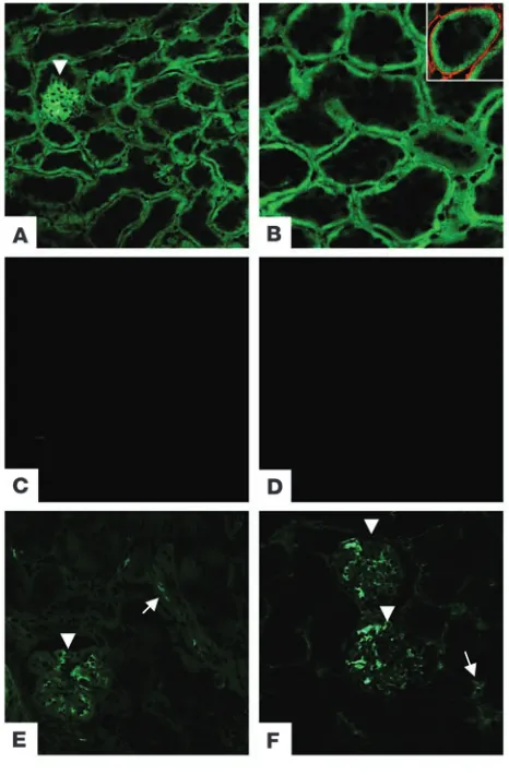 Figure 1Localization of membrane-bound complement inhibitors within the 