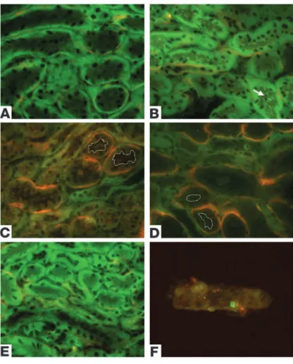 Figure 5The polarity of Crry is lost after I/R. Immunofluorescence microcopy 