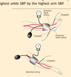 Table 3. The Ankle-Brachial Index.