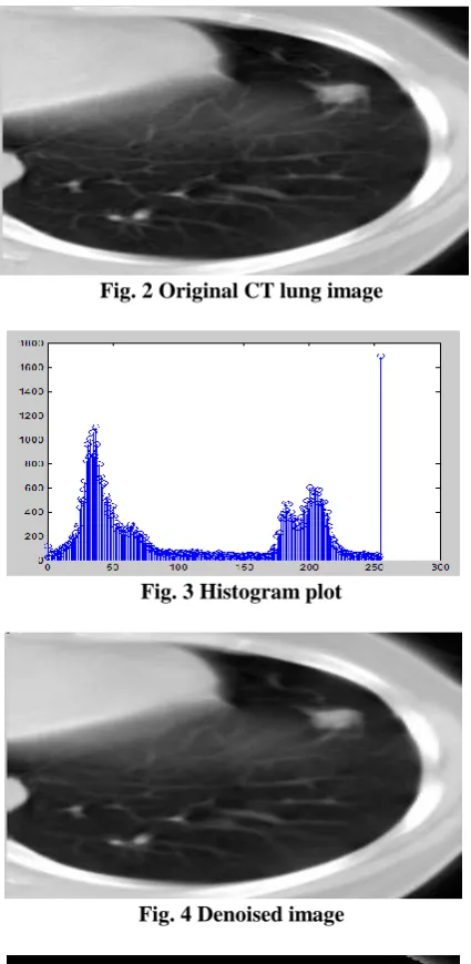 Fig. 2 Original CT lung image 