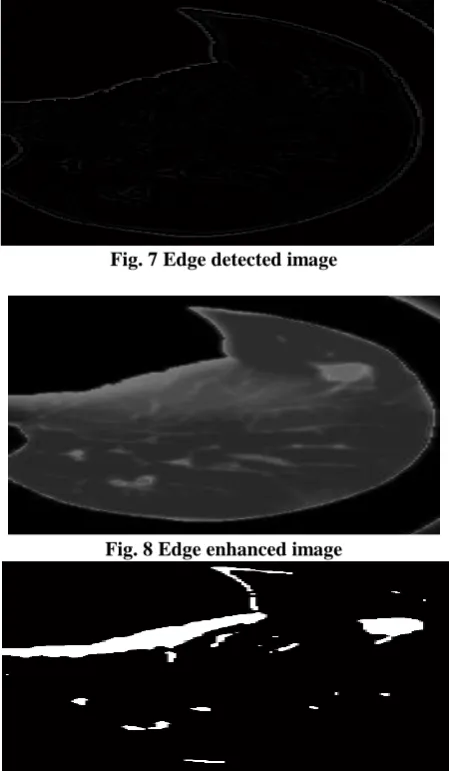 Fig. 7 Edge detected image  