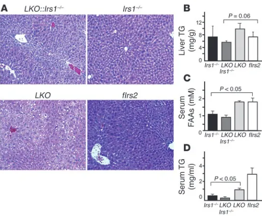 Figure 8Lipid metabolism. Type 2 diabetes is associated with Lipid metabolism in the LKO::Irs1–/– mice