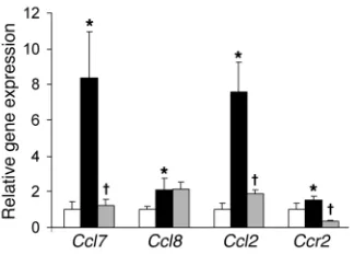 Figure 2Body mass of Ccr2–/– mice. (A) C57BL/6J Ccr2+/+ (black symbols) and Ccr2–/– (gray symbols) mice were fed a low-fat (triangles) or a high-fat diet (squares) for 24 weeks