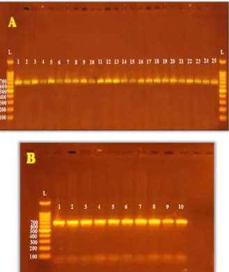 Figure 1: Gel electrophoresis for PCR products of PTPN22 gene exon 14 on agarose gel (1.8%) after electrophoresis for 1 hour at 5 v/cm2 in the presence of 1 kb DNA Ladder marker