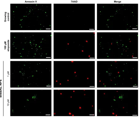 Figure 4 genotoxic effect of BisBal NPs on McF-7 breast cancer cells.filter. Red arrow indicates the stellar morphology