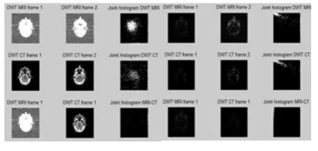 Fig. 5 Joint histogram of CT and MRI images 