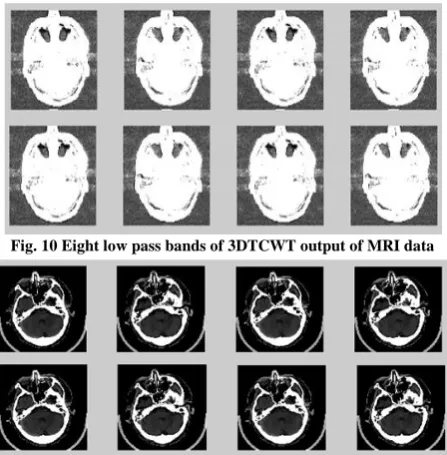 Fig. 10 Eight low pass bands of 3DTCWT output of MRI data 