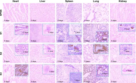 Figure 6  Pathological changes of the heart, liver, spleen, lungs, and kidney after tail vein injection with different sized IONPs (200× on the 5th day, he staining)