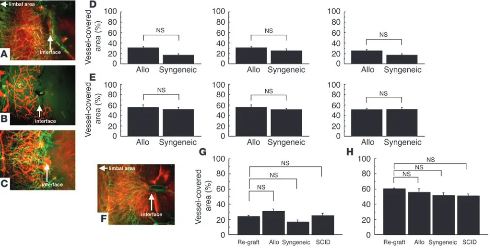 Figure 2Comparison of hemangiogenesis and lymphangiogenesis after PKP. (A–C) Photomicrographs of immunofluorescence images 7 days after 