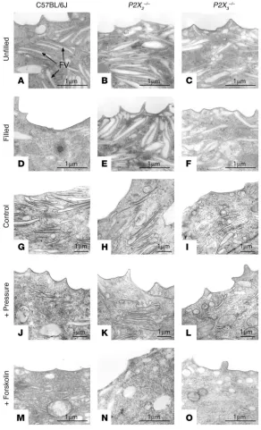 Figure 6Transmission electron microscopy (TEM) analysis of apical pole of umbrella cells in wild-type and knockout mice