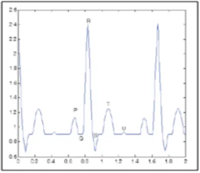 Fig.1ECG Signal with its components 