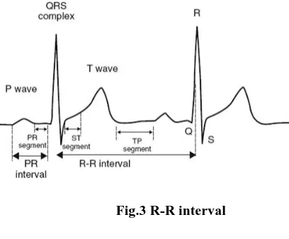 Figure 3 shows the R-R interval with general ECG waveform [10]. 
