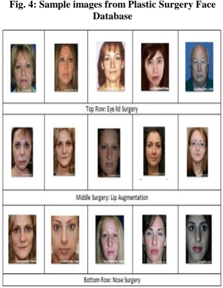Fig. 4: Sample images from Plastic Surgery Face  Database 