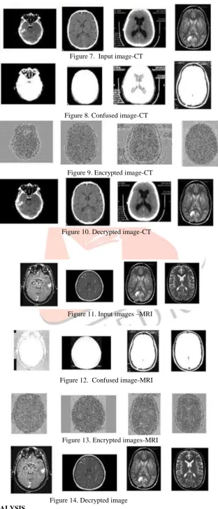 Figure 7.  Input image-CT 