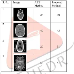 Table 2 represents PSNR calculations of MRI scan- ABE algorithm vs. Proposed algorithm  