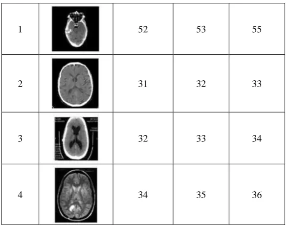 Table 4 represents hash algorithm analysis for MRI scan 