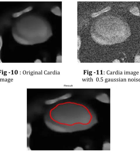 Fig -9: Segmented noisy cortex image with proposed method with parameters alpha and beta 0.1 & kappa and gamma 0.5  